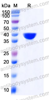 Recombinant Human TALDO1 Protein, C-His