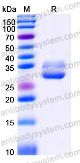 Recombinant Human CTRL Protein, C-His