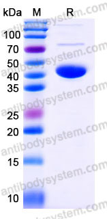 Recombinant Human ADH7 Protein, C-His