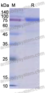 Recombinant Human STAT3 Protein, C-His