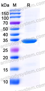 Recombinant Human MDH2 Protein, C-His