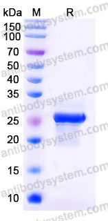 Recombinant Human PTGDS Protein, C-His