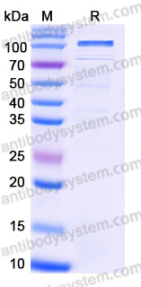 Recombinant Human CD212/IL12RB1 Protein, C-Fc