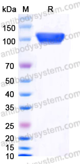Recombinant Human ECE1 Protein, N-8*His