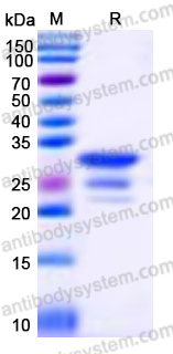 Recombinant Human TFPI2 Protein, C-His