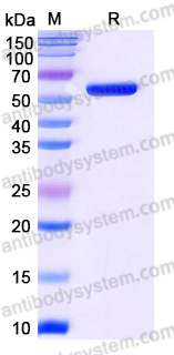 Recombinant Human PIP4K2A Protein, C-His