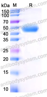 Recombinant Human IFNAR2 Protein, C-His