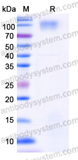 Recombinant Human MASP1 Protein, C-His
