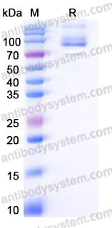 Recombinant Human INPP1 Protein, C-His