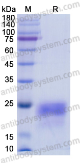 Recombinant Human PGF/PlGF/PLGF Protein, C-His