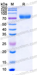 Recombinant Human CD239/BCAM Protein, C-His