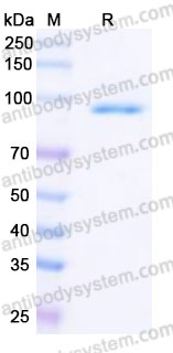 Recombinant Human MECP2 Protein, C-His