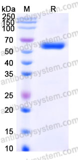 Recombinant Human SGSH Protein, C-His