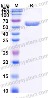 Recombinant Human LUM/Lumican Protein, C-His