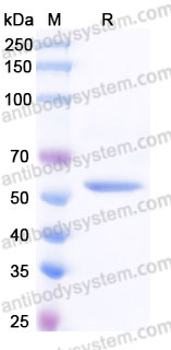 Recombinant Human PGD Protein, C-His