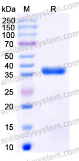 Recombinant Human EFNA3 Protein, C-His