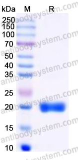Recombinant Human EFNA4 Protein, C-His
