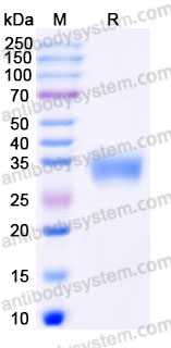 Recombinant Human STC1 Protein, C-His