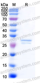 Recombinant Human CRISP3 Protein, C-His