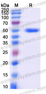 Recombinant Human PNLIPRP1 Protein, C-His