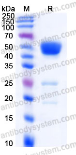 Recombinant Human PNLIPRP2 Protein, C-His