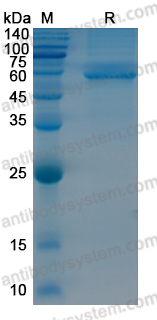 Recombinant Human RAD23B/HR23B Protein, N-His