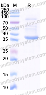 Recombinant Human MFAP4 Protein, C-His