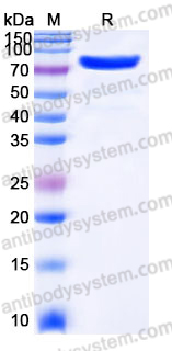 Recombinant Human CDH11 Protein, C-His