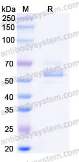 Recombinant Human GFRA1 Protein, C-His