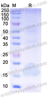 Recombinant Human IL2 Protein, C-His