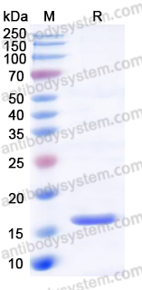 Recombinant Human UBE2B Protein, C-His