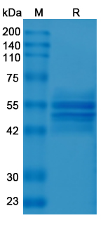 Recombinant Human CD156b/ADAM17 Protein, C-His