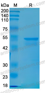 Recombinant Human CD156b/ADAM17 Protein, N-GST-His
