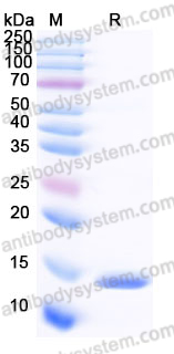 Recombinant Human CXCL6/GCP-2 Protein, C-His