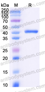 Recombinant Human SORD Protein, C-His