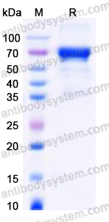 Recombinant Human PSG9 Protein, C-His