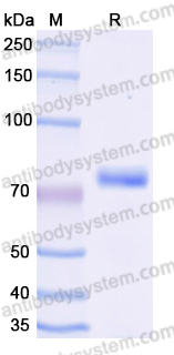 Recombinant Human CD125/IL5RA Protein, C-Fc