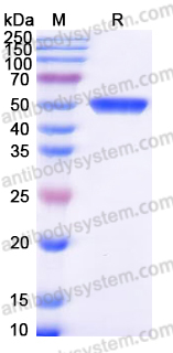 Recombinant Human GALK2 Protein, C-His