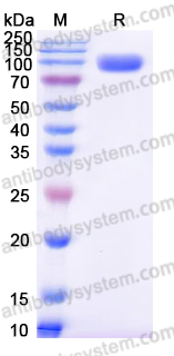Recombinant Human ROR1/NTRKR1 Protein, C-Fc