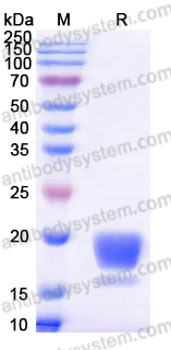 Recombinant Human ROR1/NTRKR1 Protein, C-His