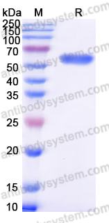 Recombinant Human ROR2 Protein, C-His