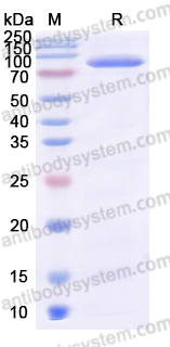 Recombinant Human ROR2 Protein, C-Fc
