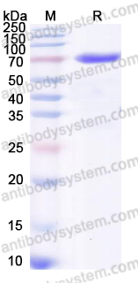 Recombinant Human NOTCH2 Protein, C-His
