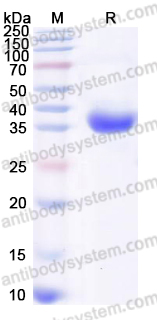 Recombinant Human CHRNB3 Protein, C-His
