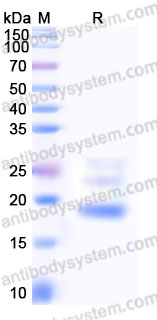 Recombinant Human CD69 Protein, N-8*His