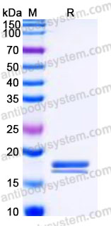 Recombinant Human CXCL9/MIG Protein, C-His