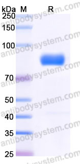 Recombinant Human CD167a/DDR1 Protein, C-hFc