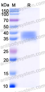 Recombinant Human CD300c Protein, C-His