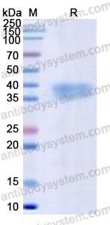 Recombinant Human CD157/BST1 Protein, C-His