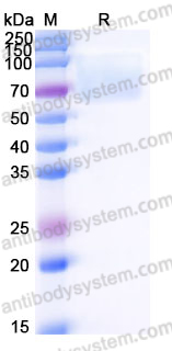 Recombinant Human MERTK/MER Protein, C-His